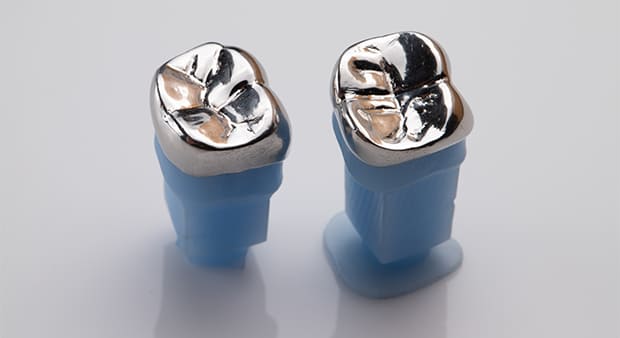 身体に優しい、金属を使わない歯科治療